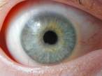 Eye.jpg