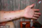 nzks-8-x-14-gauge-wrist.jpg