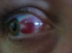91 Pac Eye_thumb.jpg