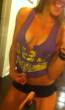 sexy-burned-bra-24.jpg